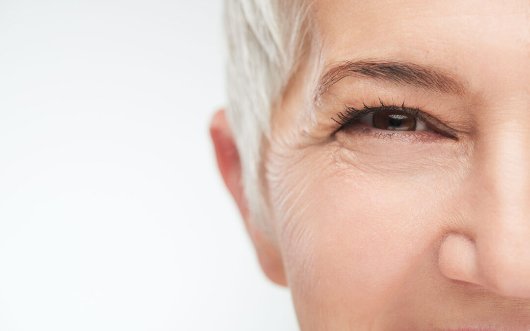 Botox Myths