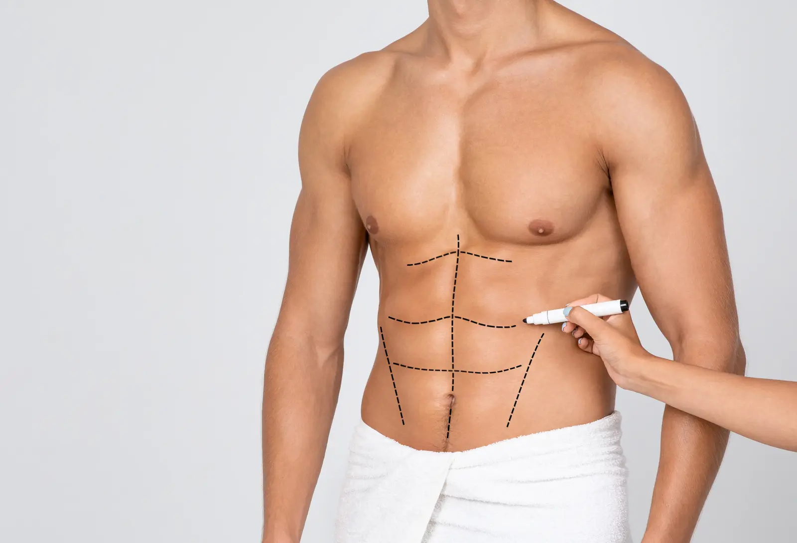 Man standing for plastic surgery