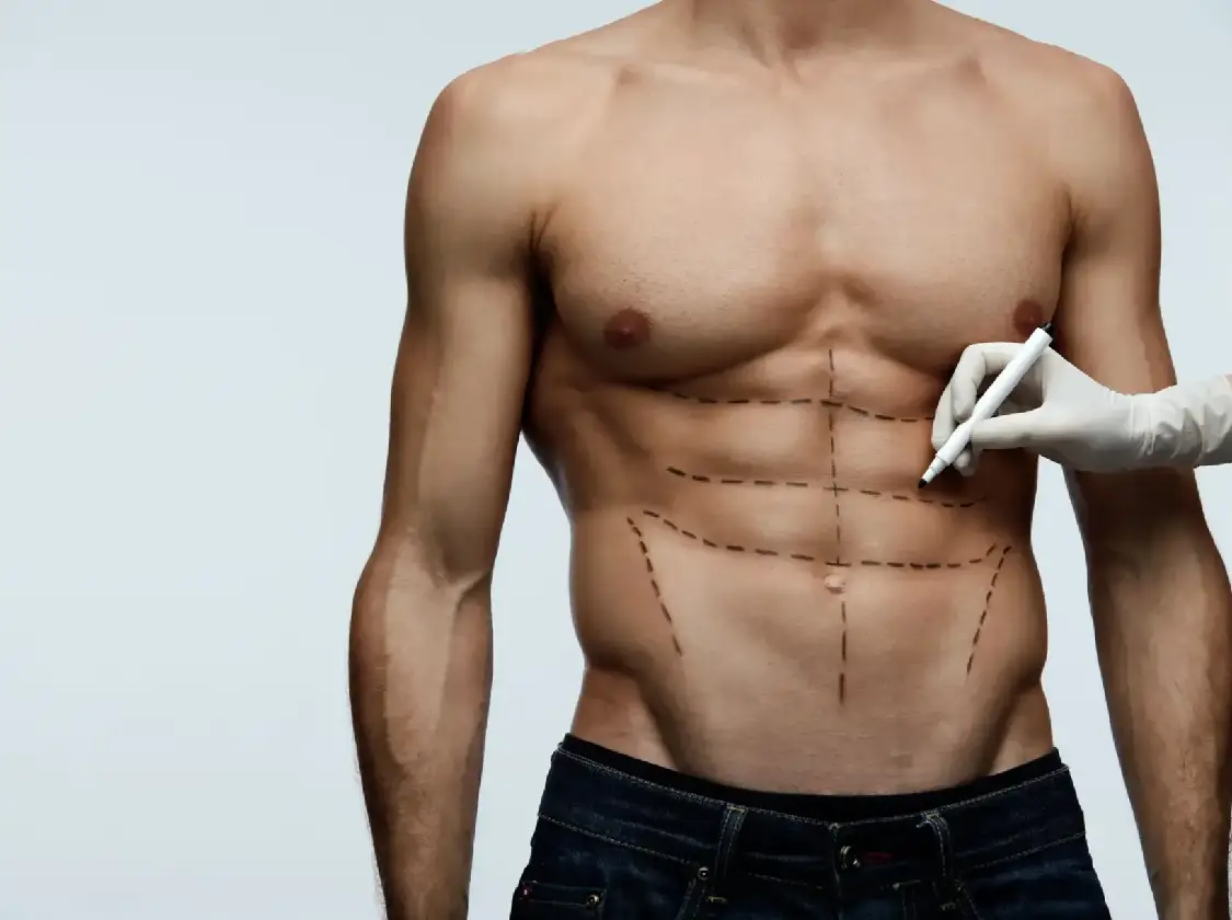 mensplasticsurgery featured image mensplasticsurgery featured image